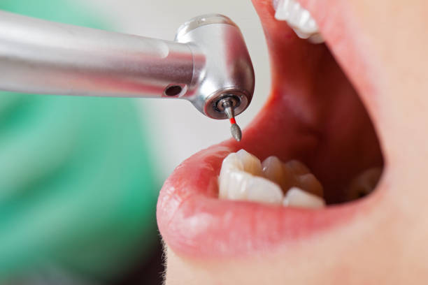 Best Cosmetic Emergency Dentistry in Carrollton, MO